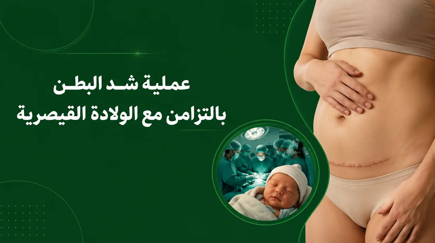 فوائد الجمع بين عملية نحت الجسم والولادة القيصرية